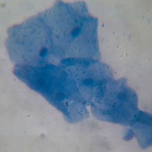 Saliva with methylene blue